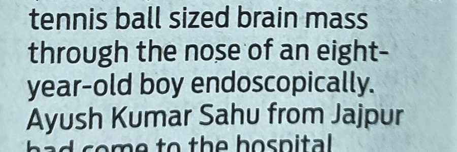 Surgeons remove tenis ball tumor in SUM ULTIMATE MEDICARE
