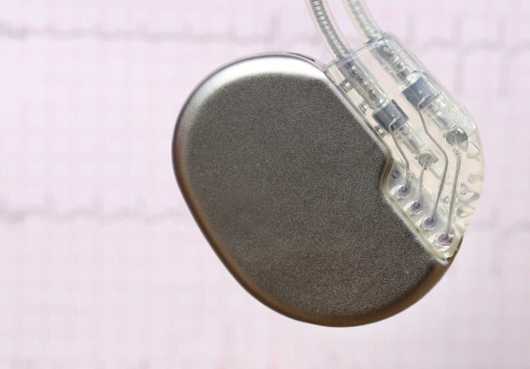 How pacemaker work