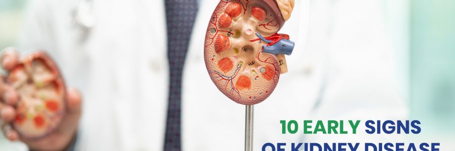 10 Early Signs of Kidney Disease You Should Never Ignore