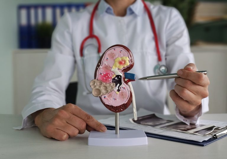 Kidney Stone Specialist