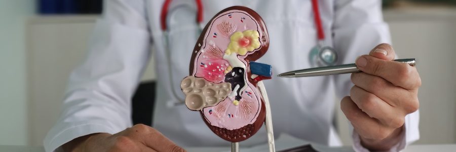 How a Kidney Stone Specialist Diagnoses and Treats Your Pain Effectively