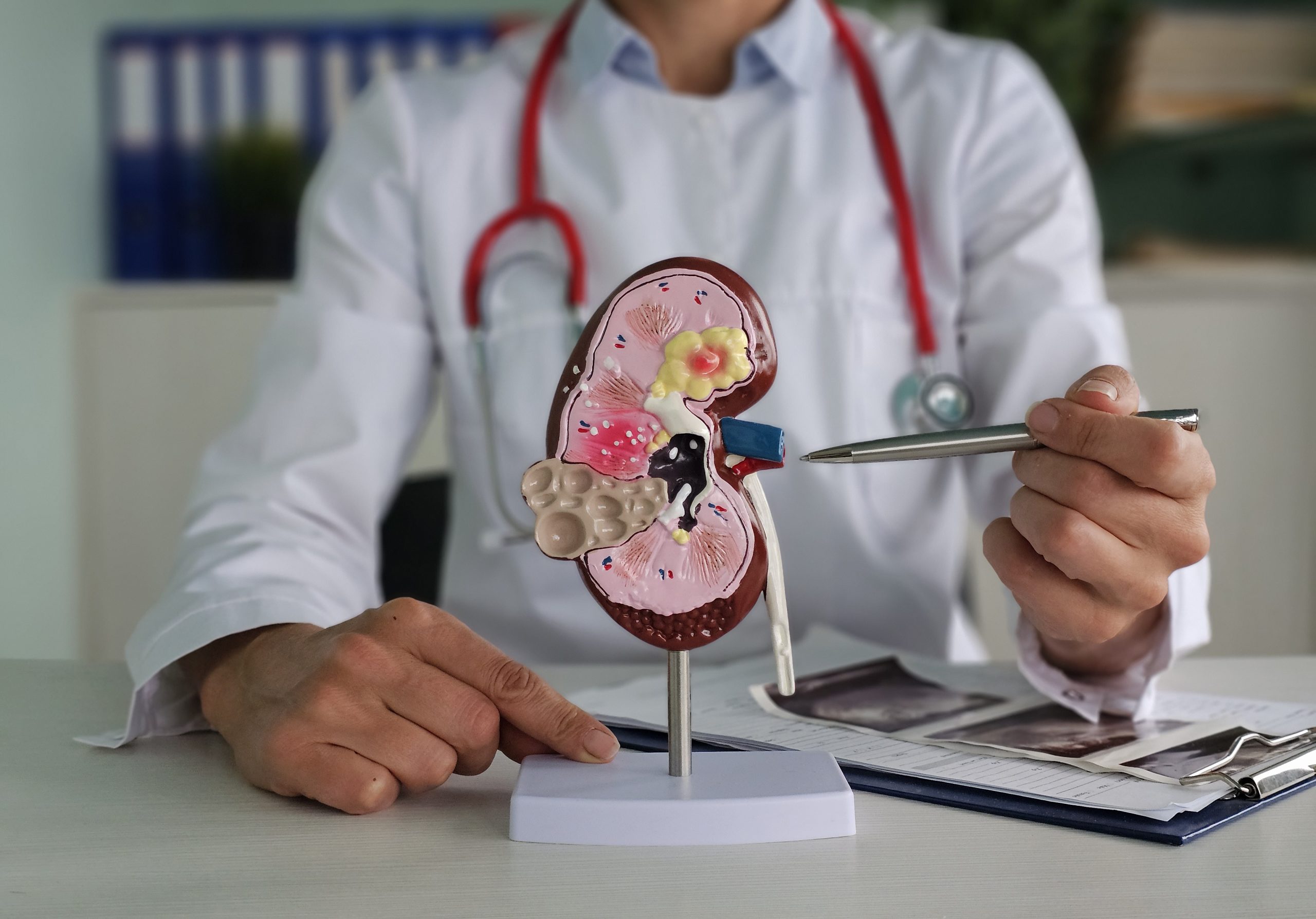 Kidney Stone Specialist